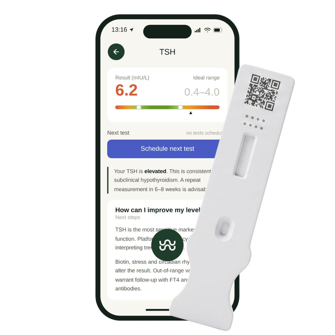 Thyroid (TSH) test